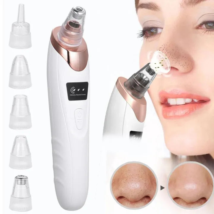 5-in-1 Electric Blackhead Remover